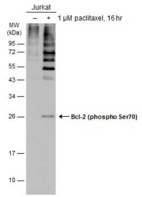 Western Blot: Bcl-2 [p Ser70] Antibody [NBP3-12895]
